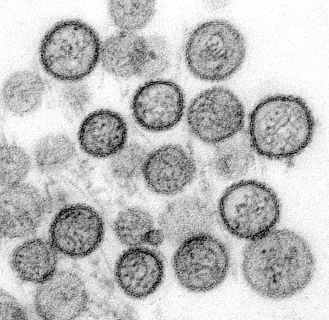 Hantavirus tipo Virus sin nombre.jpg